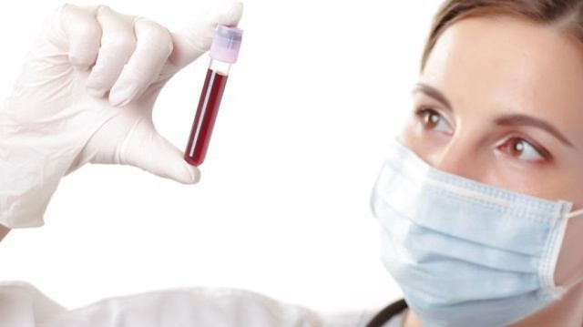 Загальний аналіз крові: норми, розшифровка аналізу крові, підготовка до аналізу крові