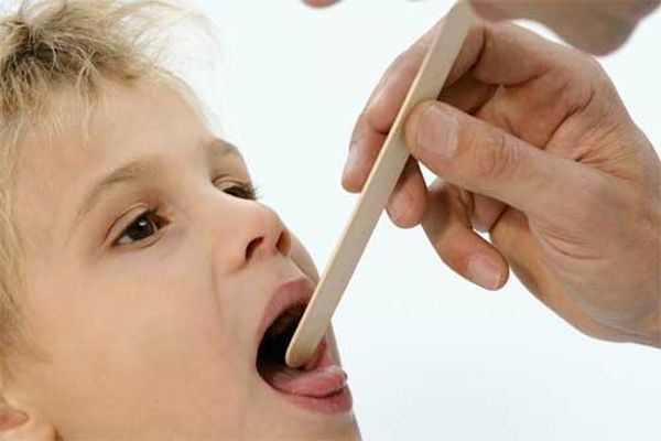 Герпетична ангіна: лікування дітей і дорослих, особливо симптомів герпетичної ангіни у дорослих і дітей