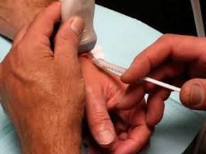 Лікування артриту лучезапястного суглоба: препарати і лікування народними засобами