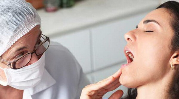 Молочниця в роті: симптоми і лікування, причини, профілактика молочниці у дітей і дорослих