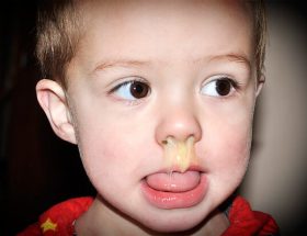 Бактеріальний риніт (нежить): симптоми і лікування у дітей та дорослих