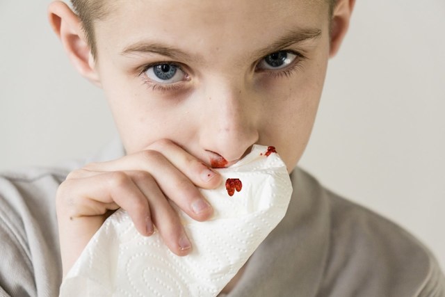 Кровотеча з носа у дітей: причини і лікування, перша допомога