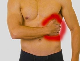Перелом грудини: види пошкоджень, супутні симптоми, тактика лікування, період реабілітації
