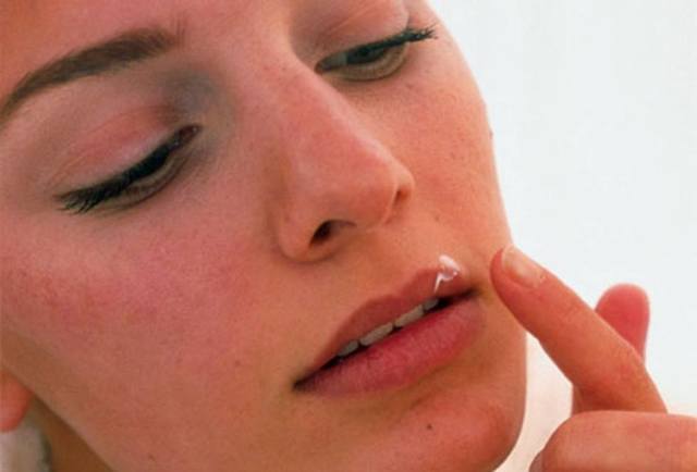 Як лікувати фурункульоз на обличчі: як позбутися від фурункулів в домашніх умовах
