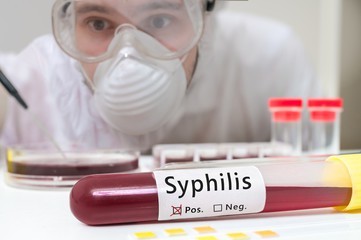 Сифіліс: шляхи зараження, симптоми, діагностика, аналізи на сифіліс та лікування.