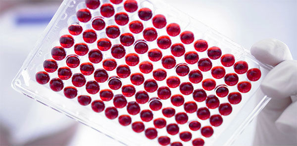 Аналіз на Хелікобактер пілорі: які тести і аналізи крові на Хелікобактер пілорі дозволяють виявити бактерії