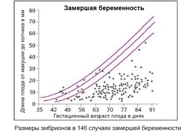 Перші ознаки вагітності, що завмерла на ранніх термінах