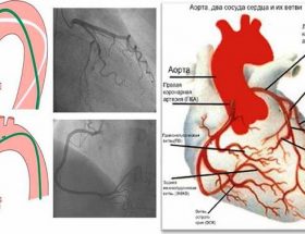 Коронарографія судин серця: різновиди діагностики, показання до проведення, можливі наслідки