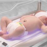 Жовтяниця новонароджених: причини, лікування, фототерапія, наслідки фізіологічної жовтяниці 