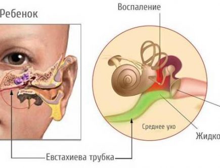 Постназальный затек у ребенка форум