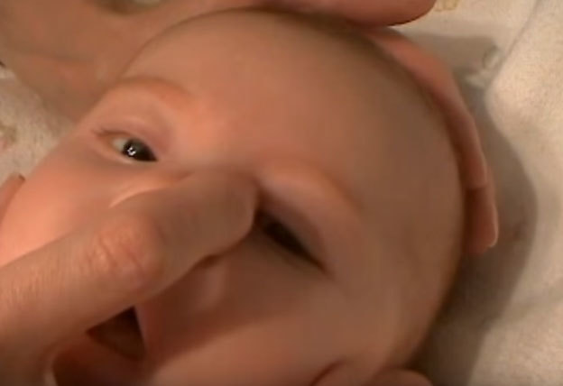 У немовляти гноїться око: що робити, якщо у дитини закисает очей