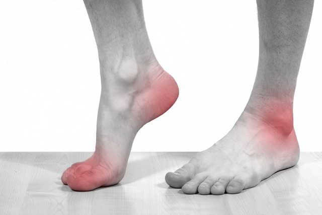 Болить стопа ноги ближче до пальців, п'яті, посередині при ходьбі: до якого лікаря звертатися