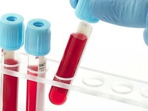 Аналіз крові на креатинін: що це таке і які нормальні значення, як підготуватися