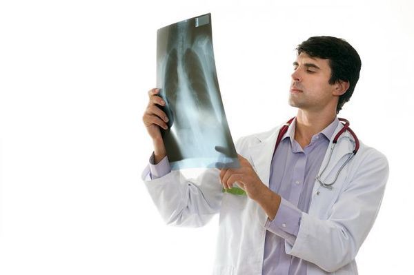 Переломи ребра: симптоми і лікування в домашніх умовах, скільки заживає перелом ребра