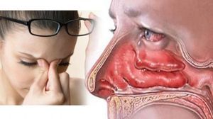 Опік носа: невідкладна допомога, діагностика, лікування, профілактика