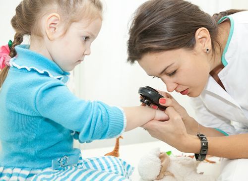 Як лікувати контагіозний молюск у дитини