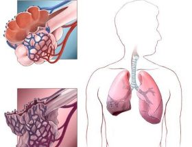 Ателектаз легенів: механізм розвитку, клінічні прояви, методи обстеження та лікування