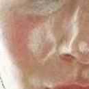 Жирна шкіра: що робити, правила догляду, домашні маски для жирної шкіри обличчя