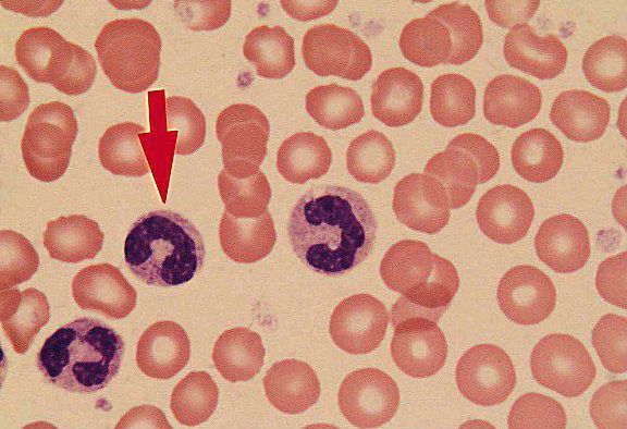 Чому нейтрофіли підвищені у дорослого, що це значить, їх норма в крові
