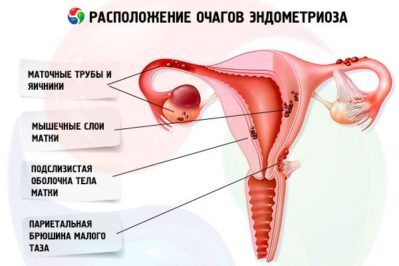 Чому з'являється кров у сечі у жінок