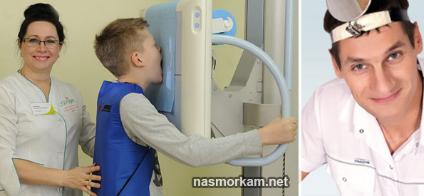 Рентген пазух носа: підготовка до процедури, показання та протипоказання
