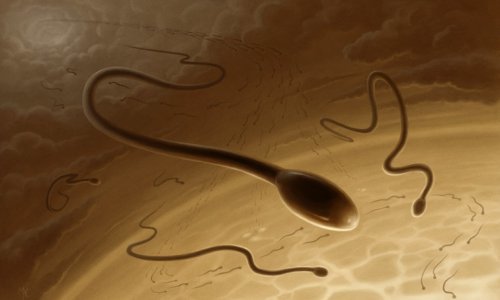 Олігозооспермія - ступеня, лікування, причини, олигозооспермия і вагітність