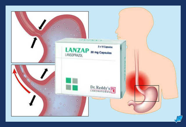 Лоензар-Сановель 30 мг: від чого допомагає, інструкція із застосування .
