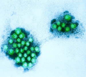 Генотипы норовируса. Норовирус симптомы. Норовирус 3д изображение. Норовирус картинки.