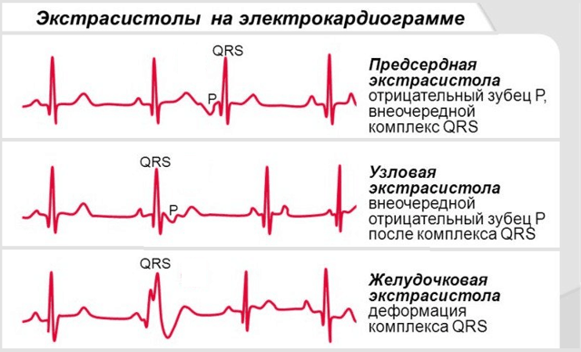 Серцевий ритм: норма серцебиття у дорослих в хвилину
