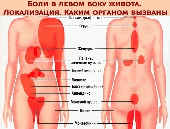 Біль в лівому боці на рівні талії спереду і зі спину у чоловіків і жінок: причини