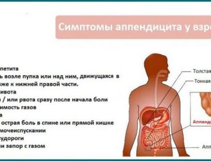 Признаки аппендицита. Начальные симптомы аппендицита у подростков. Симптомы аппендицита у мужчин 20 лет. Аппендицит симптомы у мужчин 30. Где находится аппендицит у мужчин.