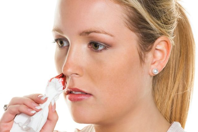 Чому йде кров з носа (в тому числі при вагітності і вранці)