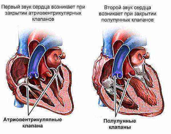 Шум в серці у дітей в 4 роки, 6, 10 років і підлітків: причини, діагностика, лікування