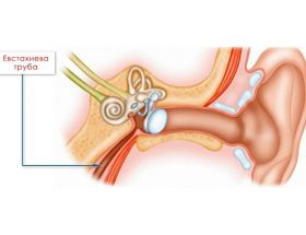 Холестеатома (сholesteatoma) вуха: що це і як проявляється?