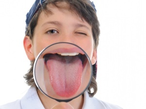 Глоссит: симптоми і лікування у дитини і дорослого, причини глоссита мови