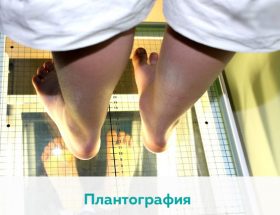 Порожня стопа: ступеня захворювання, причини розвитку, діагностика та придатність до служби