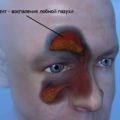 Рентген пазух носа: що показує, як часто можна робити, розшифровка