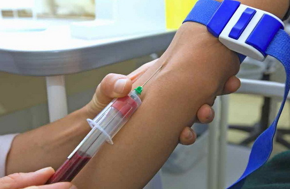 Аналіз крові за методом ІФА: розшифровка, призначення, необхідність визначення антитіл.