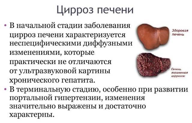 Урсосан і алкоголь - сумісність, через скільки можна пити, наслідки