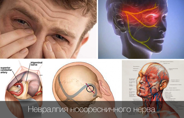 Болить ніс і голова: причини, яка зв'язок, правильна діагностика