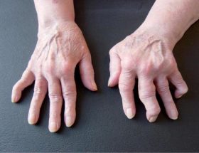 Болять пальці рук: можливі захворювання, клінічна картина, діагностика і принципи лікування