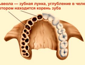 Симптоми і лікування альвеоліту після видалення зуба: докладні фото запального процесу
