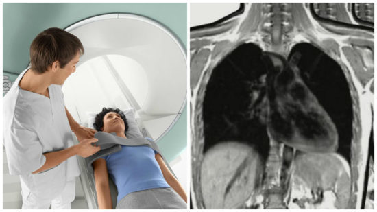 МРТ грудної клітини - що показує, як роблять, підготовка до МРТ