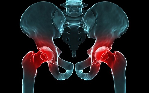 Біль в тазостегновому суглобі при ходьбі: причини, діагностика, лікування