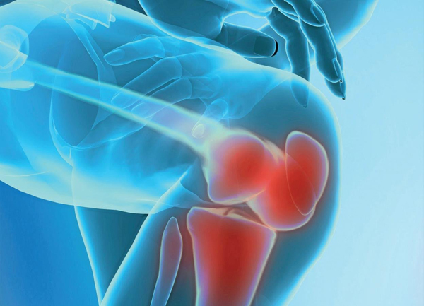 Ниє коліно в стані спокою і при згинанні клацає: причини і лікування