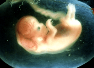 Аборт за медичними показаннями: особливості