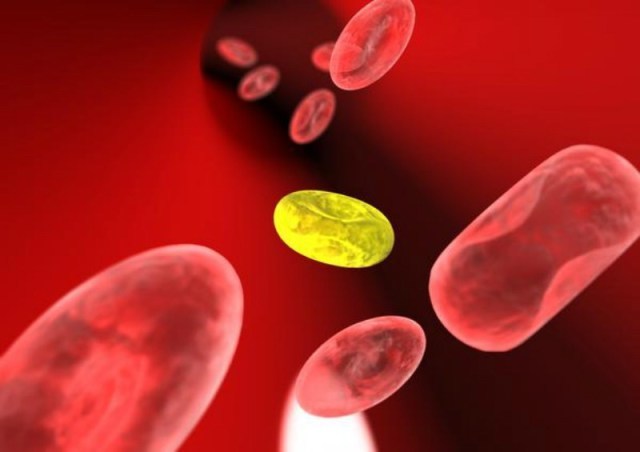 Підвищений білірубін в крові: причини і лікування
