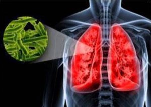 Туберкульоз печінки: симптоми і перші ознаки, як передається, діагностика і лікування