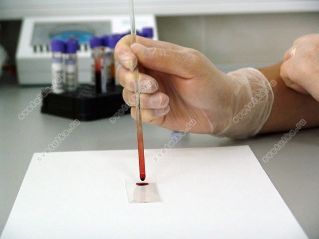 Як визначити вірусна або бактеріальна інфекція за аналізом крові