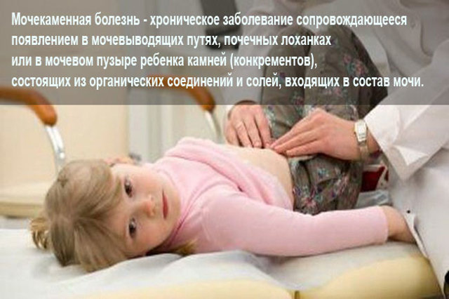 Камені в сечовому міхурі у дітей: причини, симптоми, лікування, профілактика у дітей